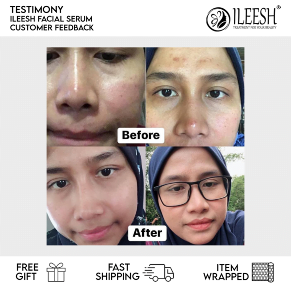 TESTIMONI 1