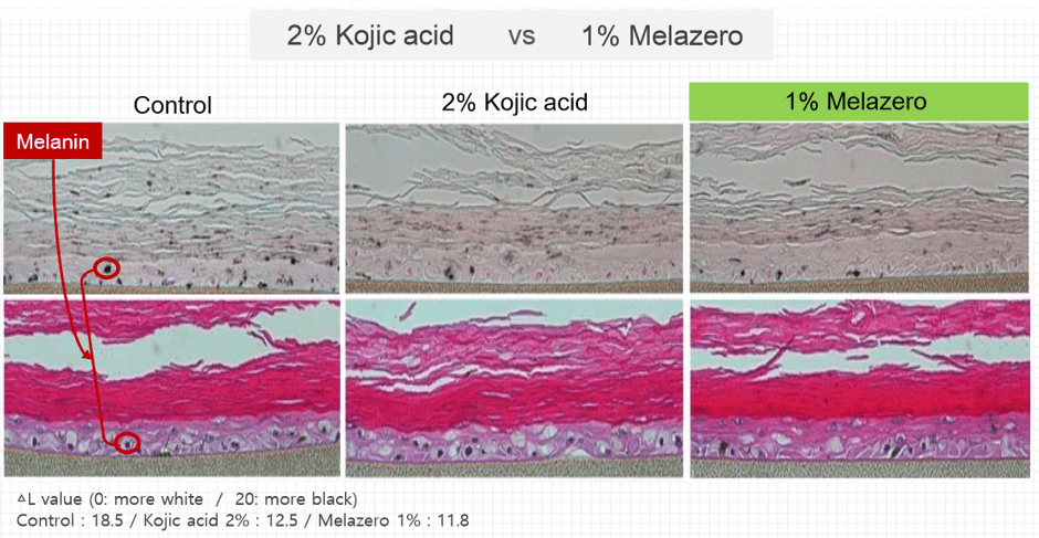 Effectiveness compared to kojic acid 1